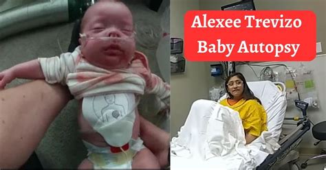 alexee trevizo baby autopsy